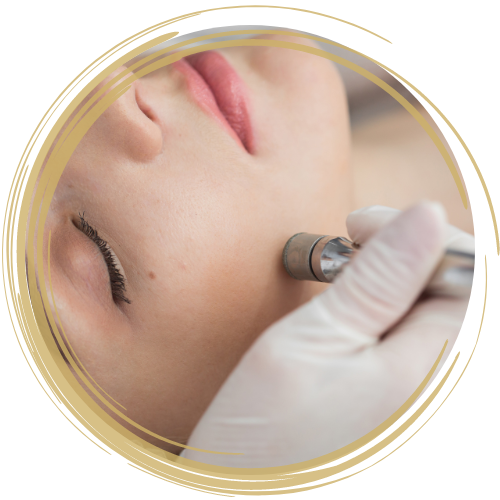 Microdermabrasion Face 